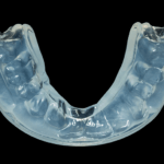 clear mouthguard custom from dentist