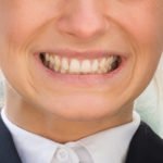 woman grinding teeth bruxism