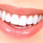 teeth bleaching results