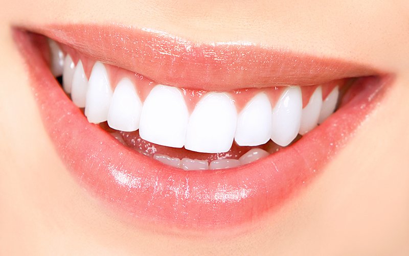 teeth whitening results