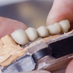 dental technician preparing dental bridge