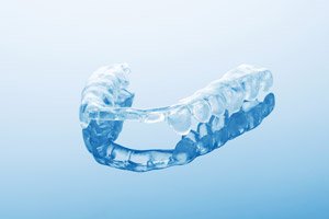 Nightguard for treating Bruxism